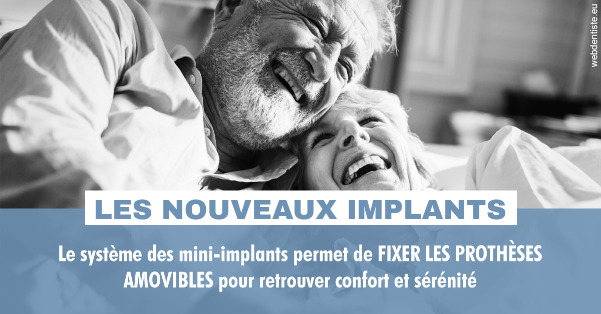 https://www.docteur-renault-hager.fr/Les nouveaux implants 2