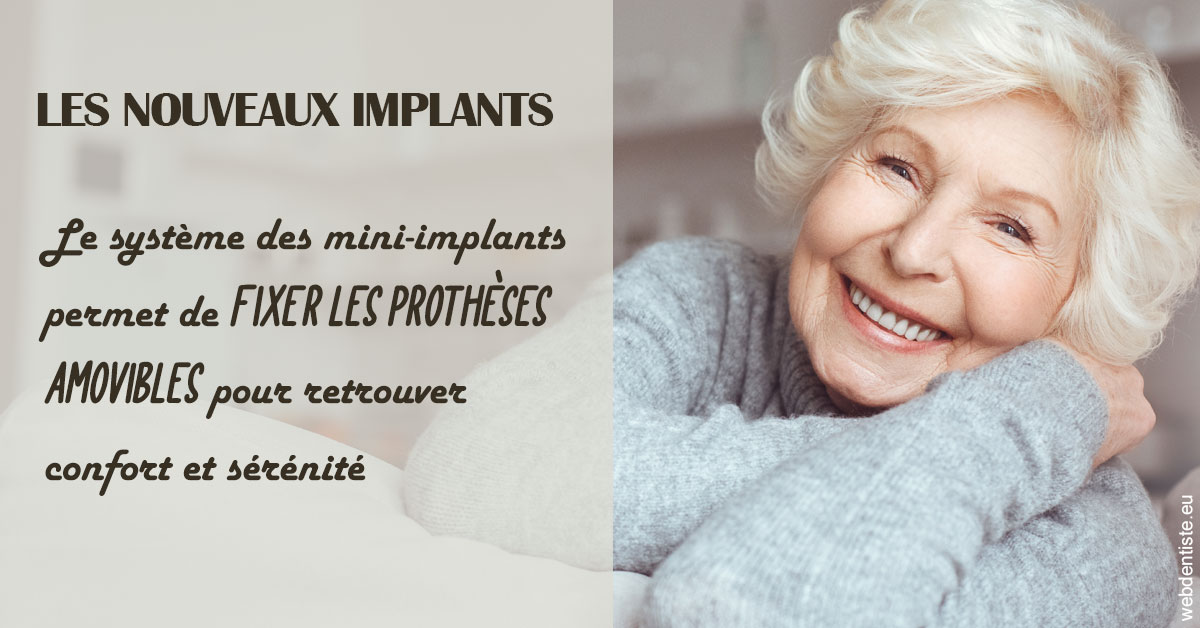 https://www.docteur-renault-hager.fr/Les nouveaux implants 1