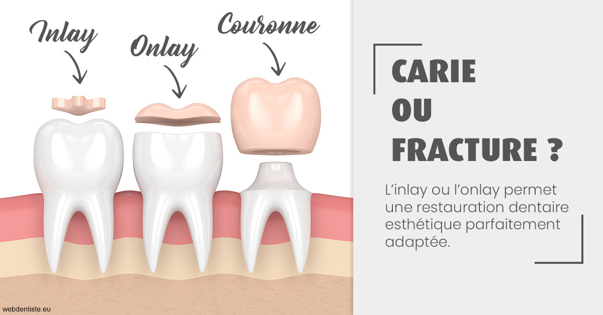 https://www.docteur-renault-hager.fr/T2 2023 - Carie ou fracture 1