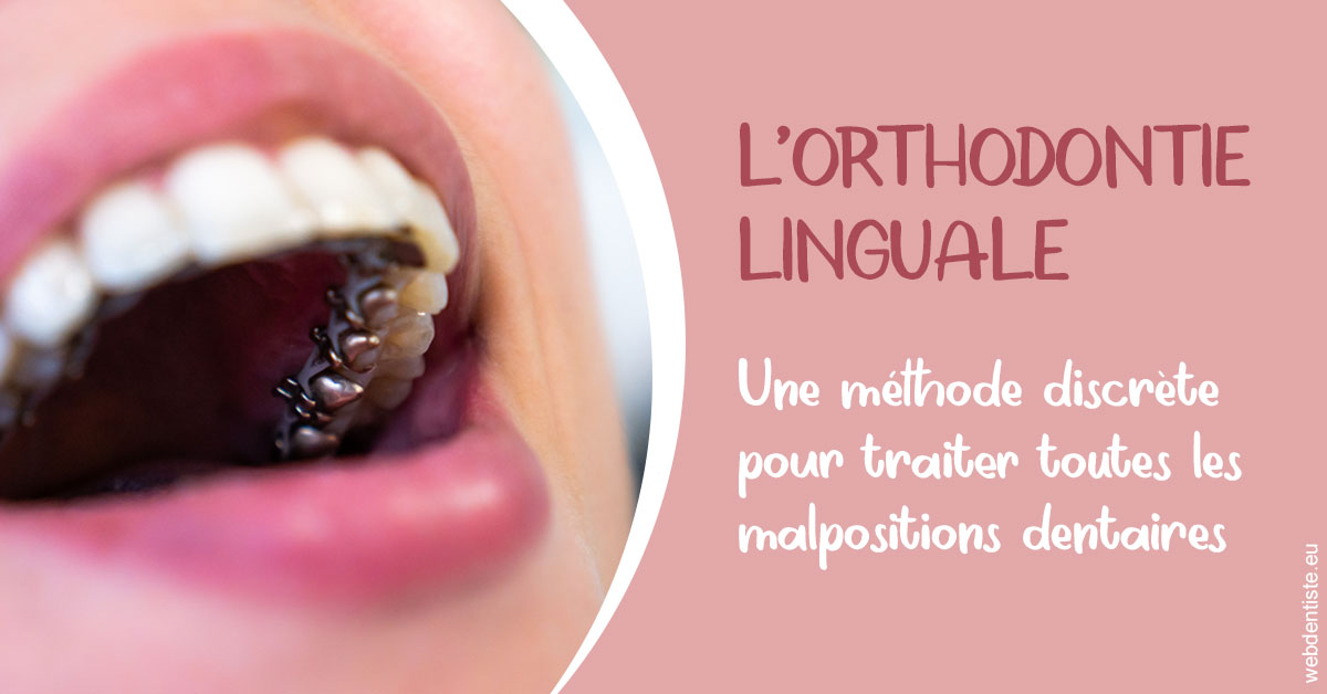 https://www.docteur-renault-hager.fr/L'orthodontie linguale 2
