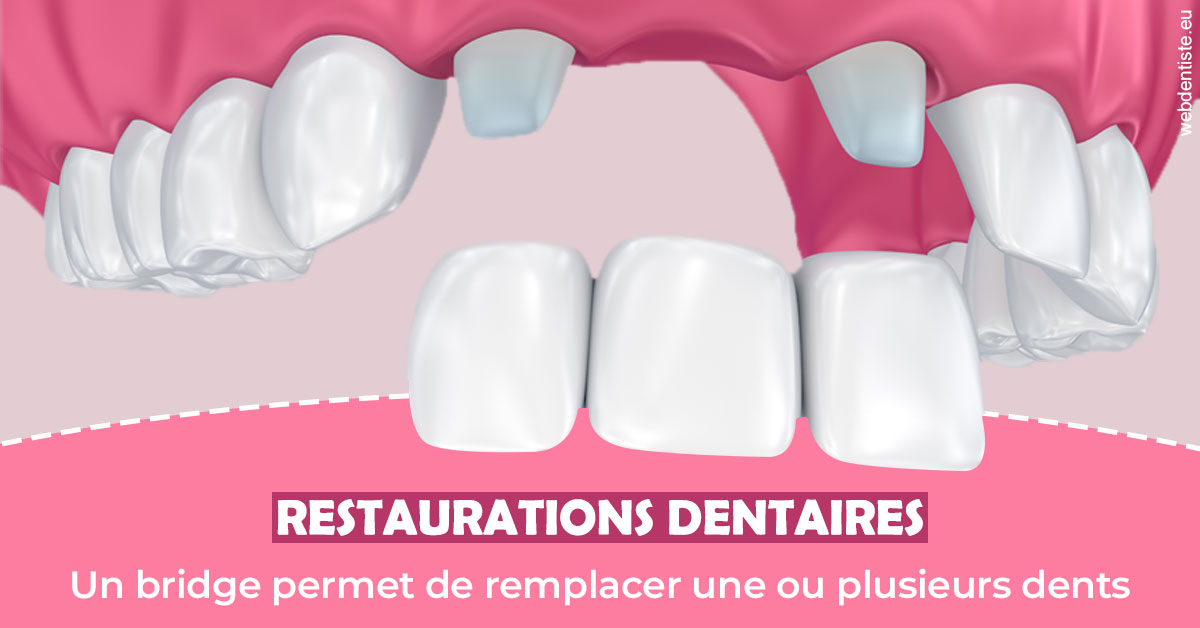 https://www.docteur-renault-hager.fr/Bridge remplacer dents 2