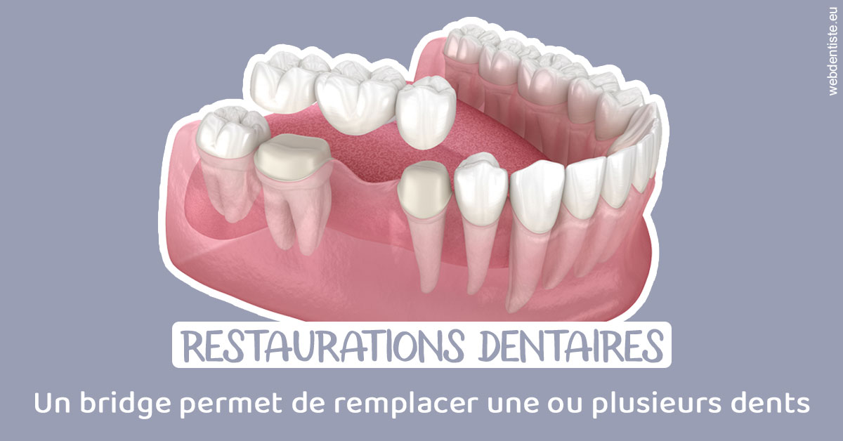 https://www.docteur-renault-hager.fr/Bridge remplacer dents 1