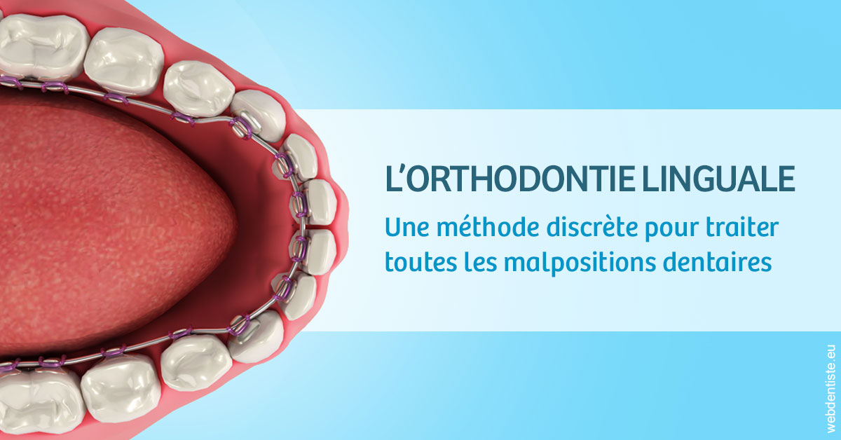 https://www.docteur-renault-hager.fr/L'orthodontie linguale 1