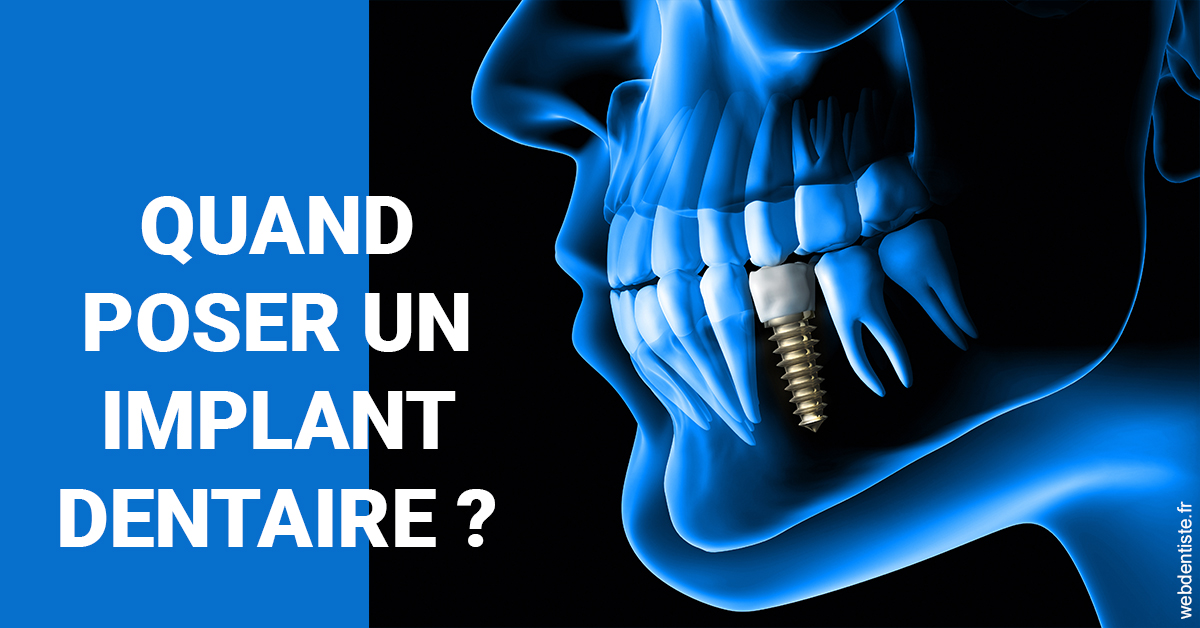 https://www.docteur-renault-hager.fr/Les implants 1