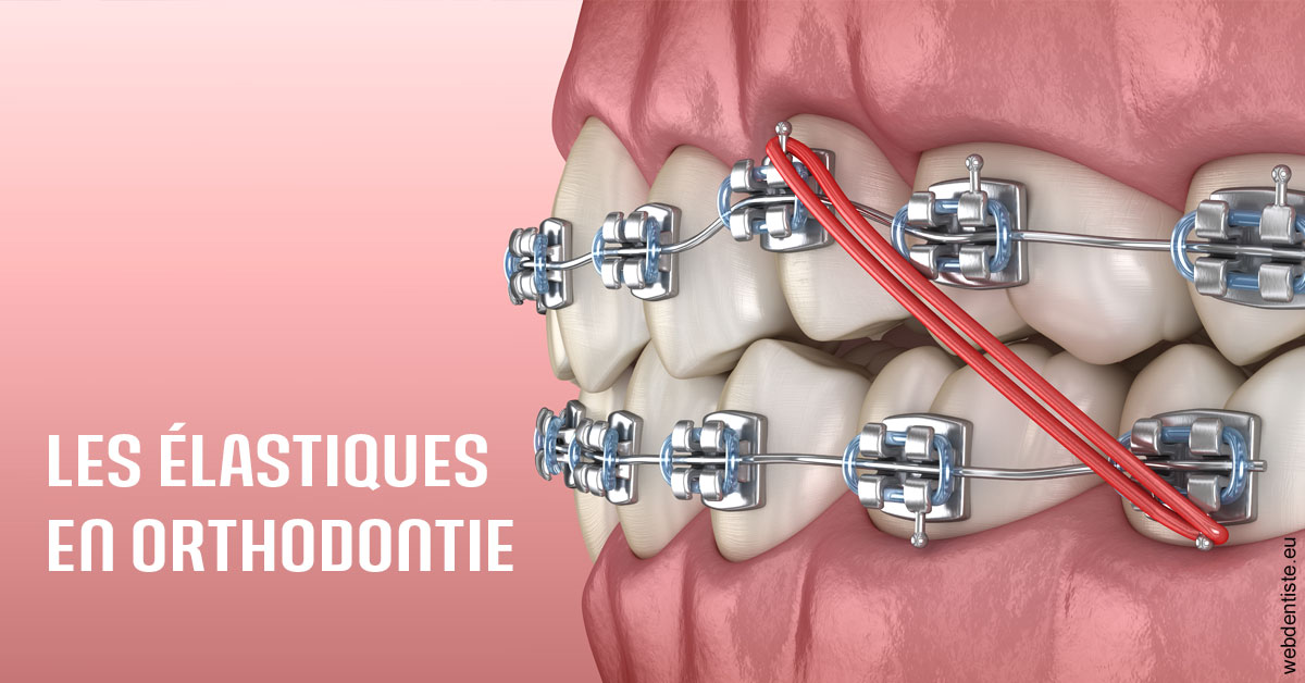 https://www.docteur-renault-hager.fr/Elastiques orthodontie 2