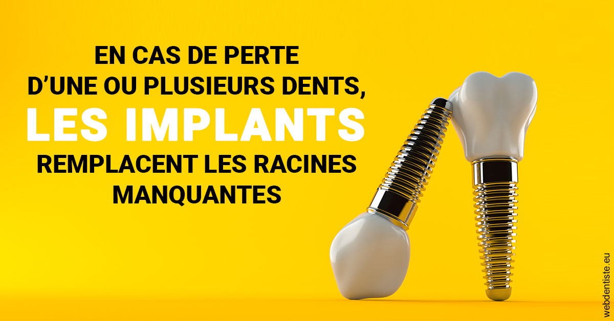 https://www.docteur-renault-hager.fr/Les implants 2